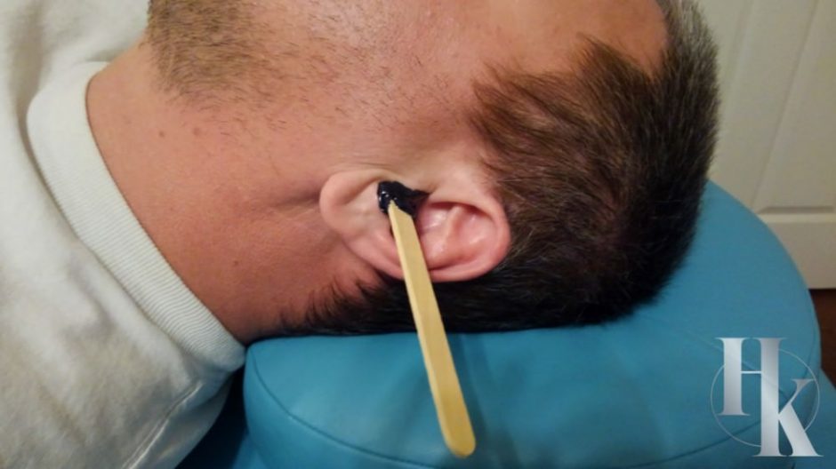 How To Get Wax Out Of Ears With Candle at Dennis Curtis blog